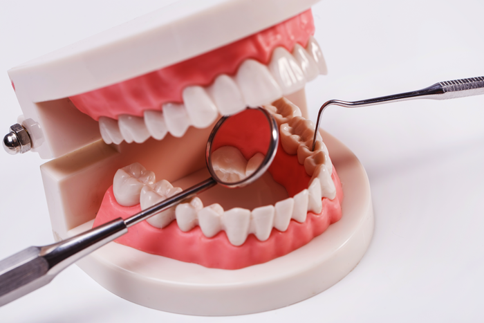 5 Tips to Preparing Root Canal Treatment (RCT)